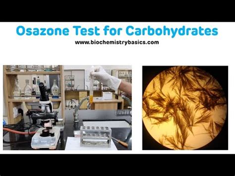 osazone test|tests for carbohydrates lab.
